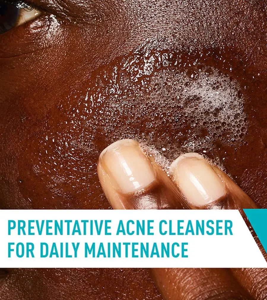 Person applying a foamy cleanser to their face with text 'Preventative Acne Cleanser for Daily Maintenance'.